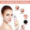 Blackhead Remover Vacuum Cleaner