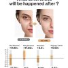 Professional Skin Tightening & Face Lifting Machine – Anti-Aging Solution for Wrinkles, Sagging & Fine Lines