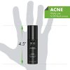 Tiege Hanley ACNE Cream for Men (ACNE)