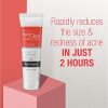 Neutrogena Rapid Clear Stubborn Acne Spot Treatment Gel