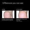 Lactic Acid Moisturizing Body Cream with OmniSome Delivery Technology for Dry Skin - Image 4