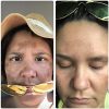 Dark Spot Corrector Remover for Face