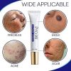 TOIDOI Pro.W Blemish Cream - Blemish Remover