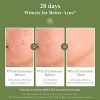 Acne Treatment Gel, BREYLEE Tea Tree Acne Spot Treatment