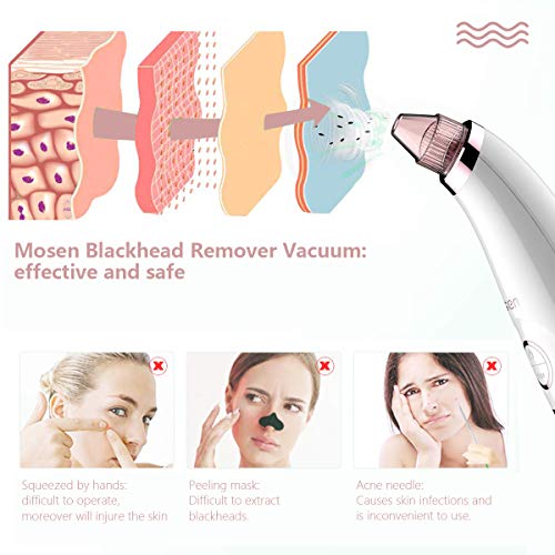 Pore Cleansing and Acne Extraction Professional Blackhead Remover Vacuum