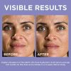 L'Oreal Paris Skincare Revitalift Derm Intensives
