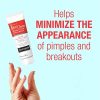 Neutrogena Rapid Clear Stubborn Acne Spot Treatment Gel