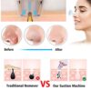 Facial Suction Cleanser Blackhead Remover Pore Vacuum