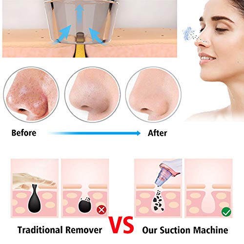 Facial Suction Cleanser Blackhead Remover Pore Vacuum