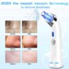 Blackhead Remover Vacuumfacial pore cleaner that utilizes electrical suction