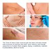 Scar Remover Gel for Scars from C-Section