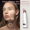 Pore Cleansing and Acne Extraction Professional Blackhead Remover Vacuum