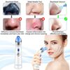 Blackhead Remover Vacuumfacial pore cleaner that utilizes electrical suction
