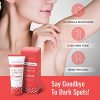 Dark Spot Corrector Cream – For All Skin Types, Face & Body, Lightens Dark Spots, Evens Skin Tone, Reduces Hyperpigmentation