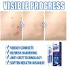 Blemish Removing Gel - Effective Dark Spot and Skin Tag Remover for Scar-Free Results