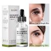 NUSPA Niacinamide 10% Plus Zinc 2% Toner for Face