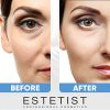 Caffeine Infused Coffee Eye Lift Cream - Reduces Puffiness