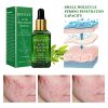 BREYLEE Tea Tree Clear Skin Serum – Powerful Acne Treatment with Camellia Sinensis Extract