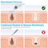 Newest Blackhead Remover Pore Vacuum