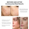 Murad InvisiScar Resurfacing Treatment - Image 3