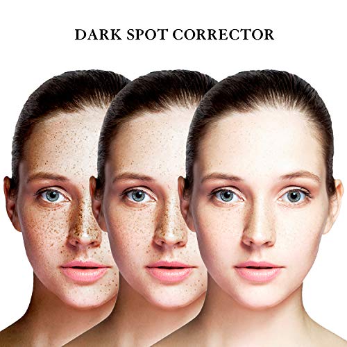 EnaSkin Dark Spot Corrector Remover for Face and Body
