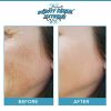 Anti Aging Resurfacing Exfoliating Peel Pads