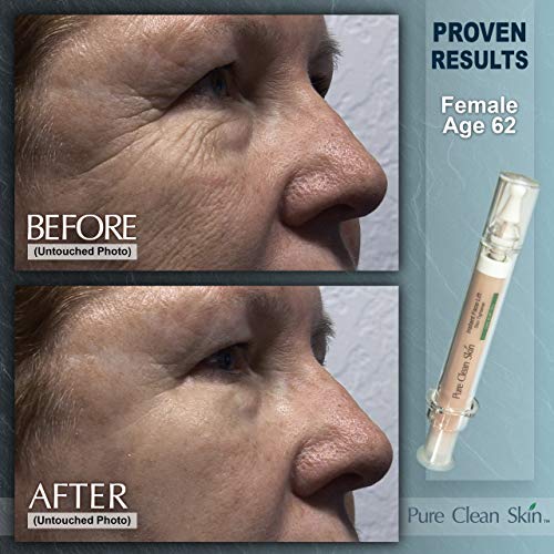 Skin Tightening Cream For Face - Get a Instant Face Lift