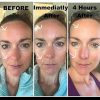 TimeWise Restore Anti-Growing old Lifting Bio-Cellulose Facial Masks - Intensive Skincare Remedy