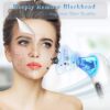 Blackhead Remover Pore Vacuum Extractor Cleansing Technology