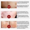 Pore Treatment Serum Essence Shrink Pores Relieve