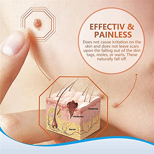 2Pcs Wart Remover Ointment for Effective and Gentle Skin Tag Removal