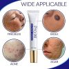 30ml Face Skin Care Scar Cream Blemishs