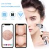 Blackhead Remover with Camera, Upgraded Pore Vacuum Cleaner