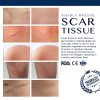 Scar Remover Gel for Scars from C-Section