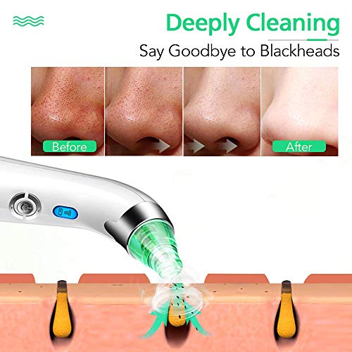 Acne Removal Blackhead Remover Pore Vacuum Cleaner