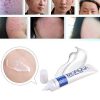 BIOAQUA Face Skin Care Acne Anti-Wrinkle Treatment