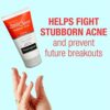 Neutrogena Rapid Clear Stubborn Acne Face Wash