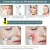 Acne, Grease, and Comedone Remover Vacuum with Camera