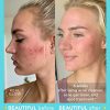 TULA Skin Care Stay Balanced Level 1 Acne Clearing Routine