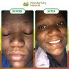 African Black Soap: Unleash Your Natural Glow with Confidence! 🌿✨