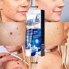 2Pcs Wart Remover Ointment for Effective and Gentle Skin Tag Removal
