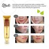 Advanced Scar and Stretch Mark Removal Gel