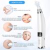 BESTOPE Blackhead Remover Pore Vacuum-Upgraded