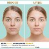 Oil and Vitamin C Acne-Clearing Serum - Image 5