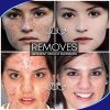 30ml Face Skin Care Scar Cream Blemishs