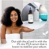 12% Niacinamide Serum for Face + Zinc PCA – Vitamin B3