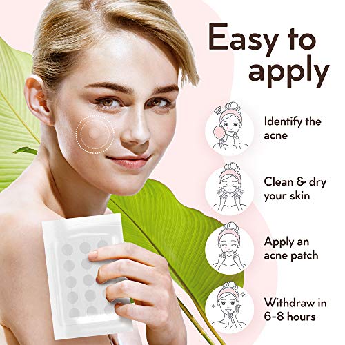 Clear Skin, Clear Confidence! A 132-Dot Set of Zit and Pimple Master Patches! 🌟🔵
