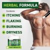 Natural Eczema Treatment with Tea Tree Oil
