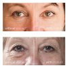 My Perfect Eyes Anti-Ageing Eye Cream Cosmetic Serum