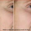Aria 3 Peptide Firming Serum with Hyaluronic Acid & Collagen - Anti-Aging Powerhouse for Skin, Face, Eyes, and Neck (1 Bottle)